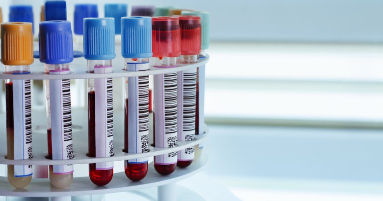 Covid-19: où passer un test d’immunité à New York ? Est-ce utile ?