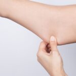 [Tuile d&rsquo;expat] Mettre un mot sur la douleur : le témoignage d’Astrid Moulin, Française à Toronto